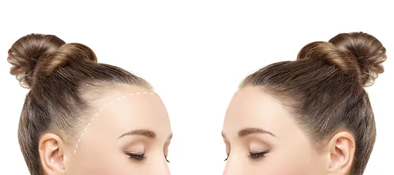 Haarpigmentierung für Frauen: Natürlich aussehende Lösungen für dünner werdendes Haar