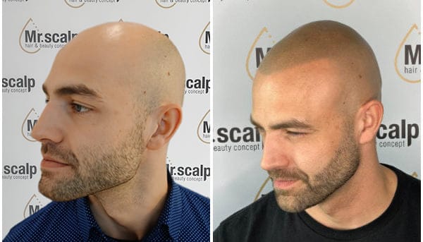 Leistungen Haarpigmentierung Mister Scalp